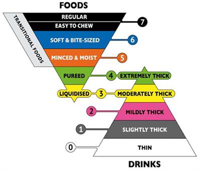 Patients with dysphagia: How to supply nutrition through non-tube feeding